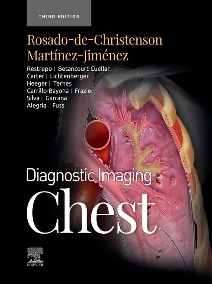 Diagnostic Imaging: Chest 3rd Edition