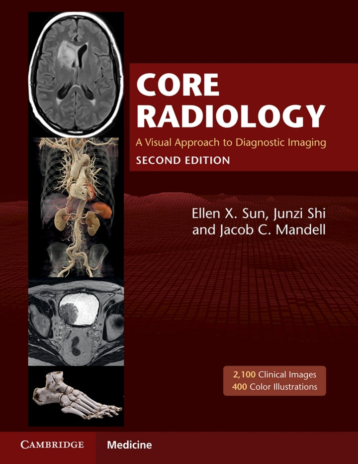 Core Radiology: A Visual Approach to Diagnostic Imaging 2nd Edition