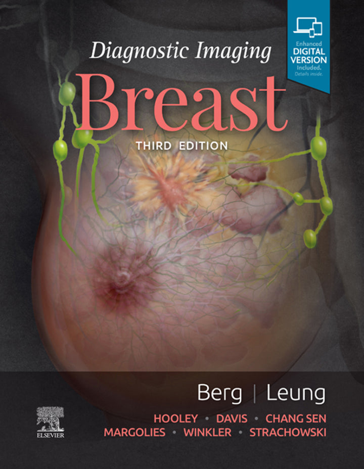 Diagnostic Imaging: Breast 3rd Edition