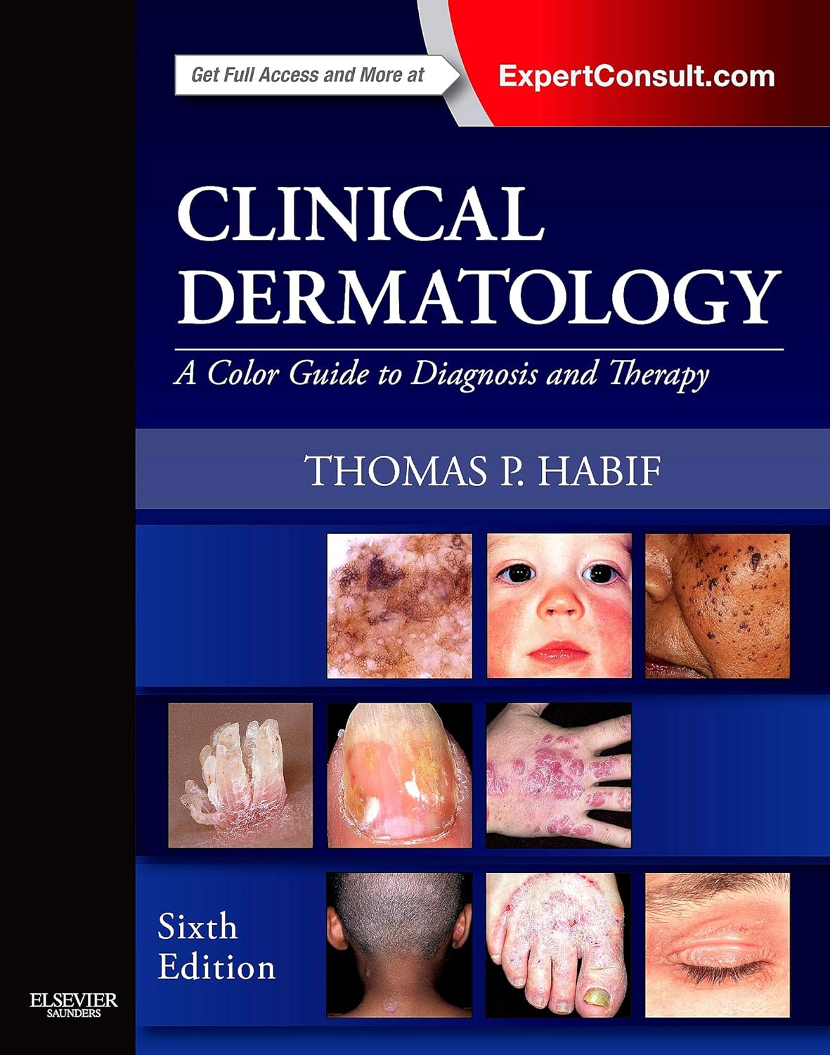 Clinical Dermatology: A Color Guide to Diagnosis and Therapy 6th Edition